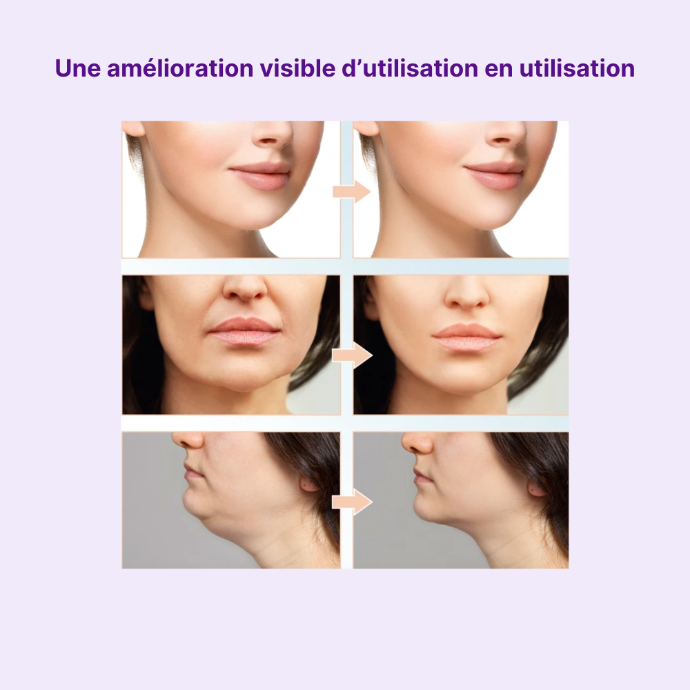 Lifter Facial contours du visage & double menton